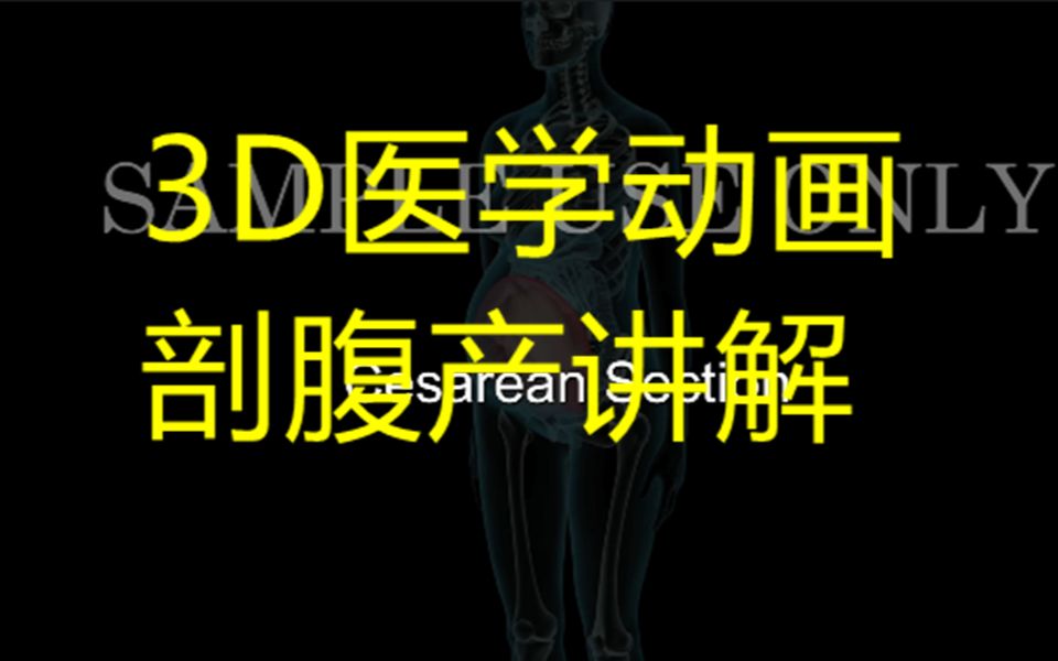 剖腹产是一种在女性的腹部和子宫上切开切口以分娩婴儿的外科手术.计划进行一些剖腹产手术.哔哩哔哩bilibili