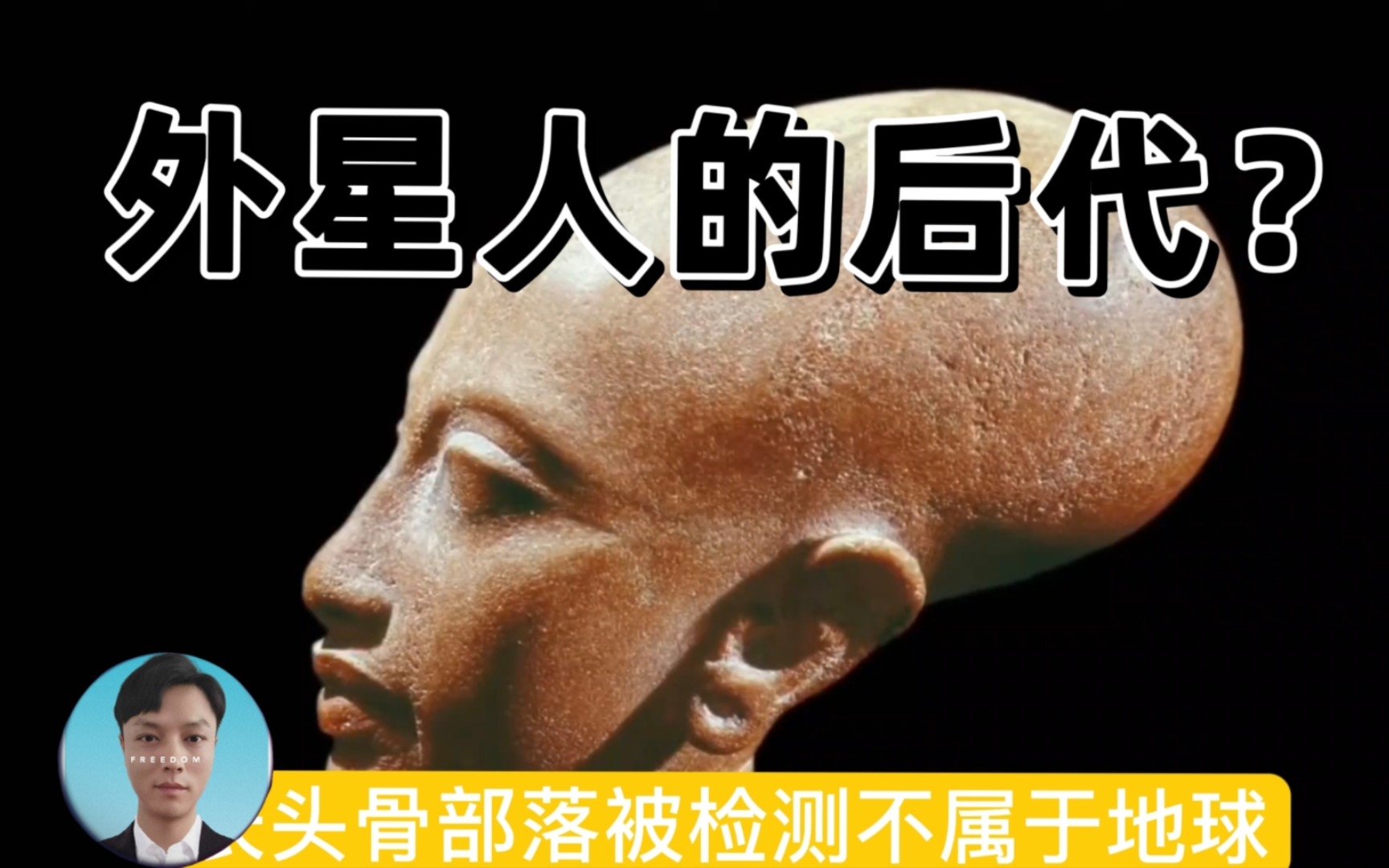 【奇闻怪谈】长头族头骨被检测出不属于地球dna,几千年前就掌握先进