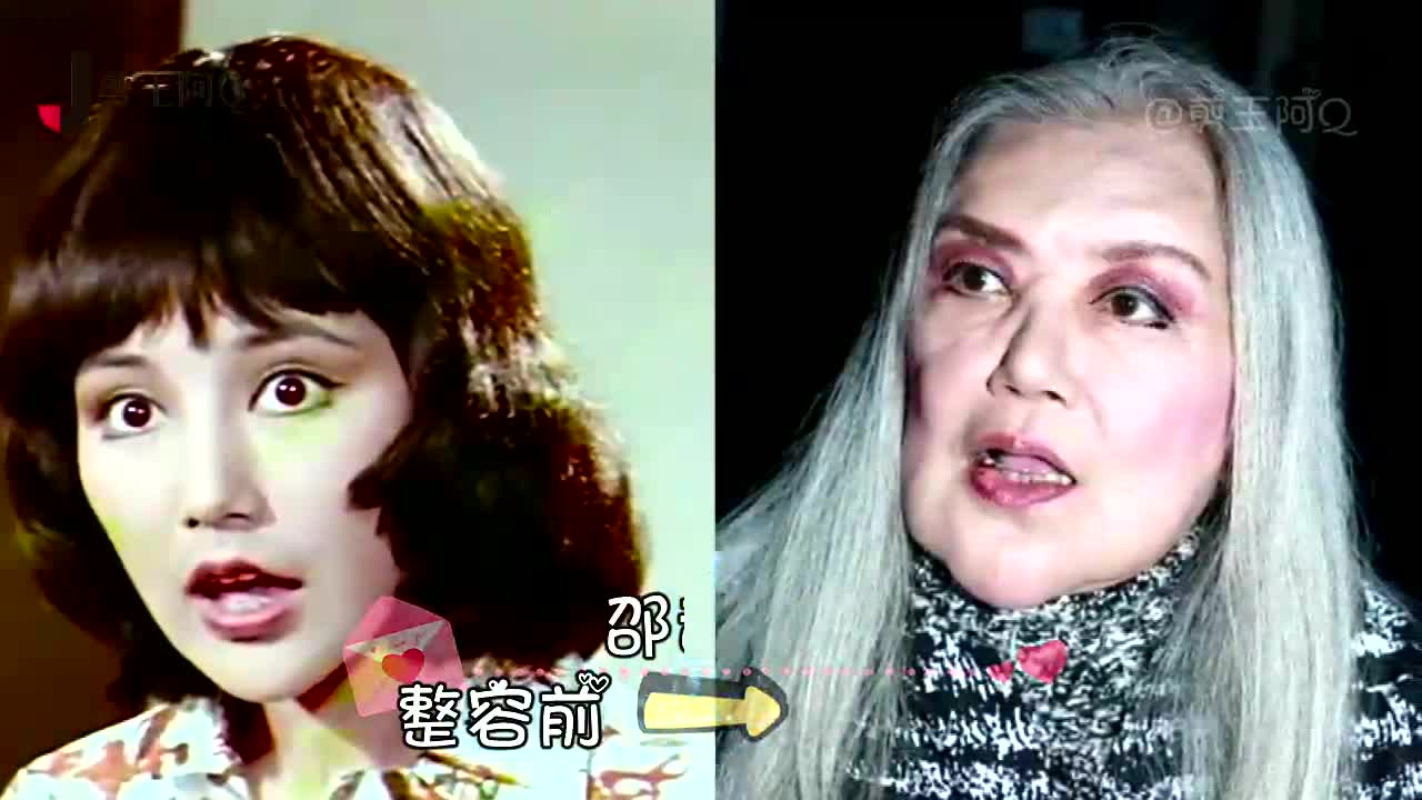 郑裕玲面部拉皮扯到变形,萧蔷女神变"僵尸脸"