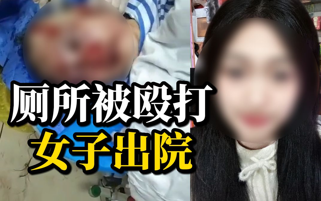 [图]厕所被殴打女子右眼视力只有0.04，复明希望很小，至今未收到道歉