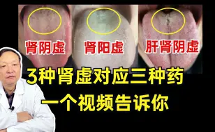 Tải video: 六味地黄丸、金匮肾气丸、杞菊地黄丸，全都能补肾，那个最适合你呢？