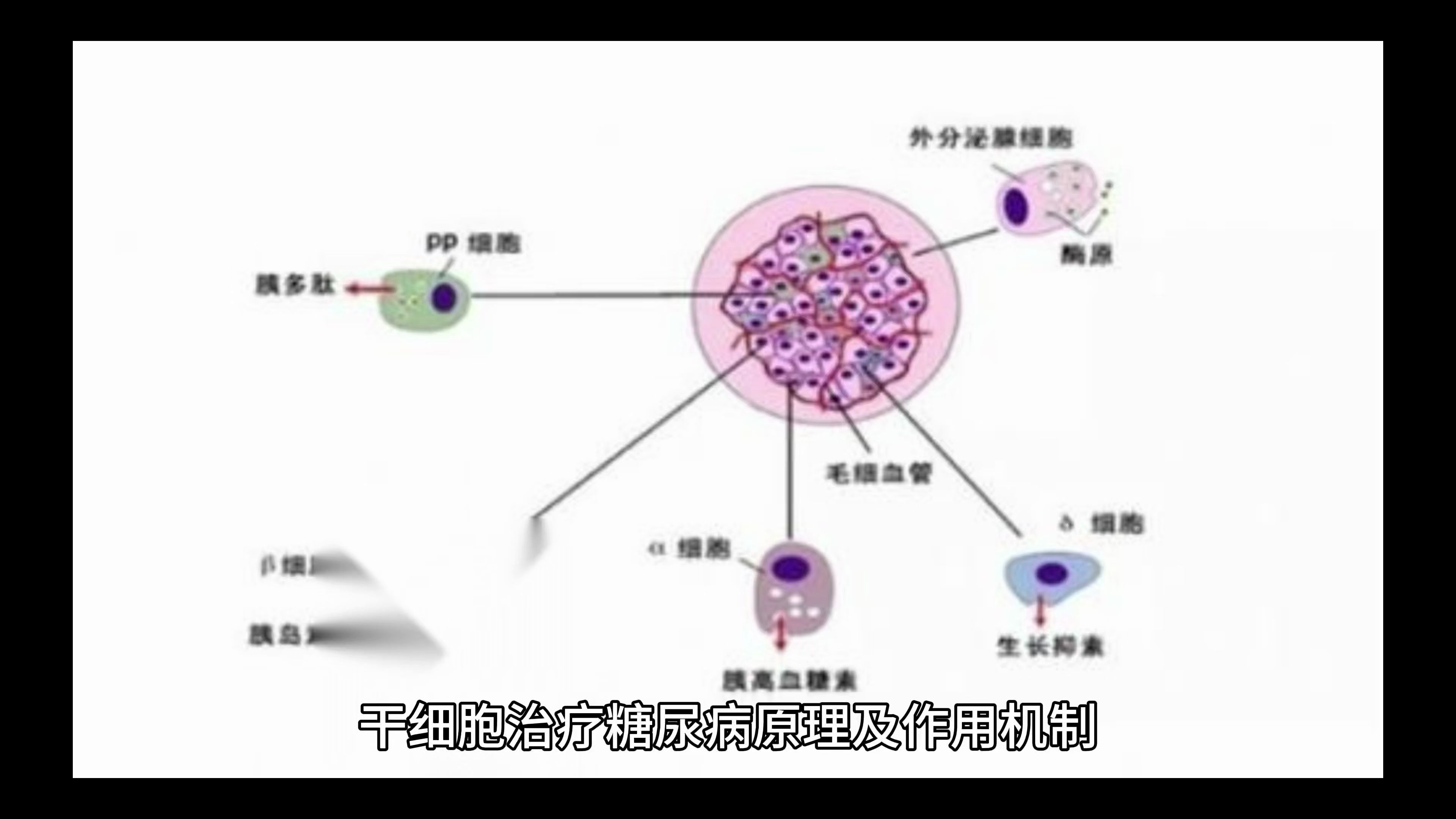 "探索干细胞科技:糖尿病治疗的新突破"