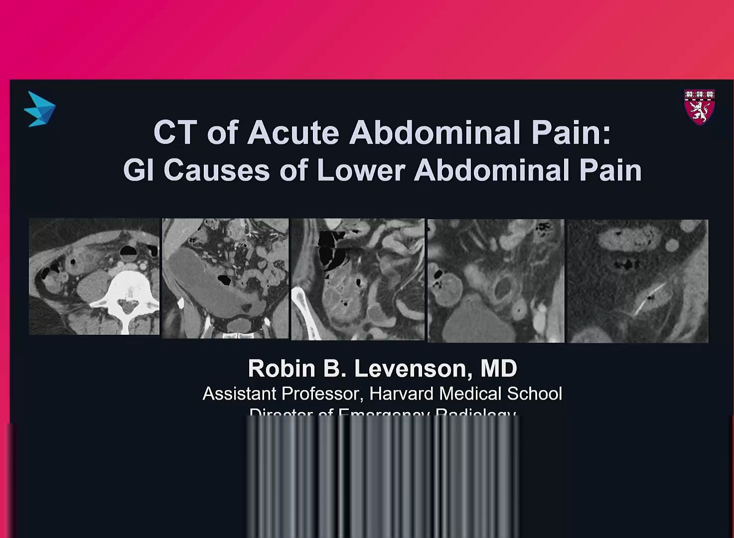 gi causes of acute abdominal pain case-based approach m3-cer06