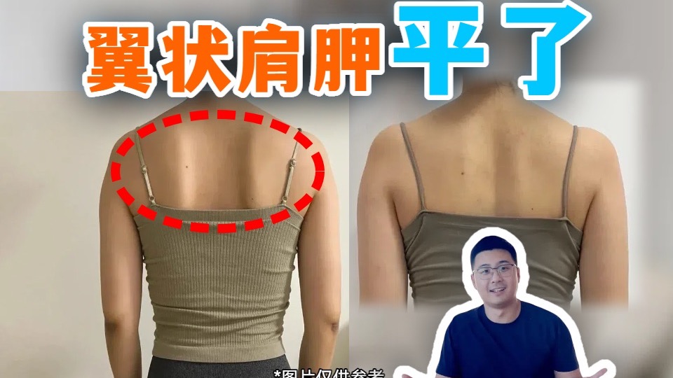 翼状肩胛,必须要练的动作