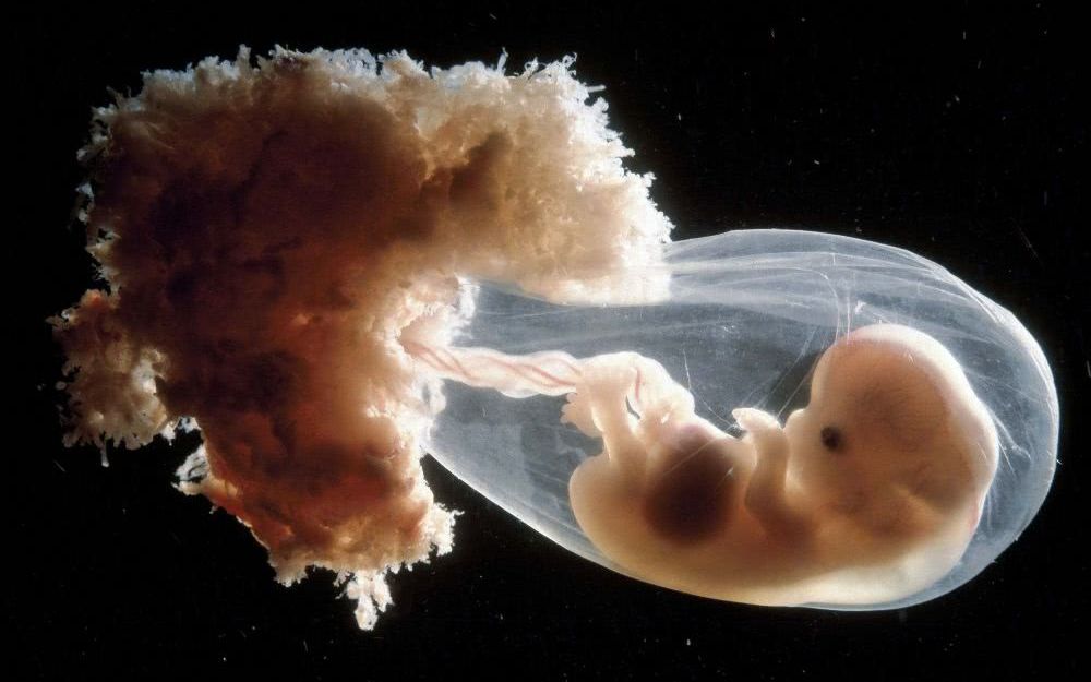 九周的胎儿有多大图片
