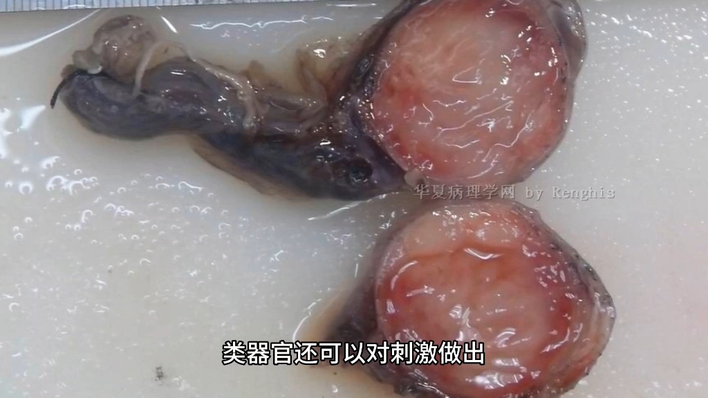 类器官智能:生物计算和神经科学的新前沿哔哩哔哩bilibili