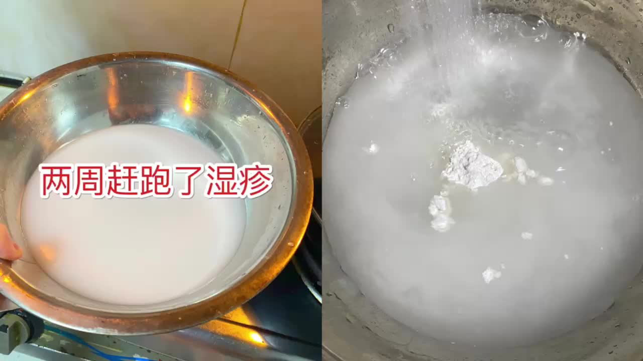 淀粉还有什么作用是我们不知道的,湿疹不再反复了哔哩哔哩bilibili