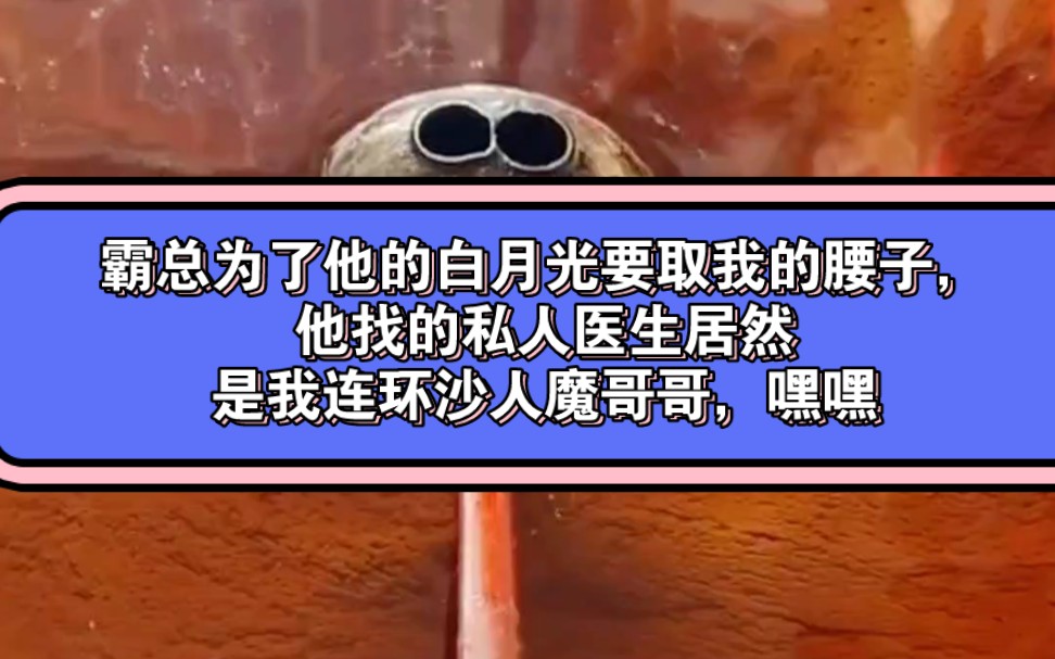 霸总为了他的白月光要取我的腰子,他找的私人医生居然是我连环沙人魔哥哥,嘿嘿