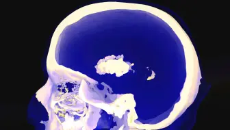 一位短视频博主吸食了奶油发泡剂，他的生活是这样毁于一旦的