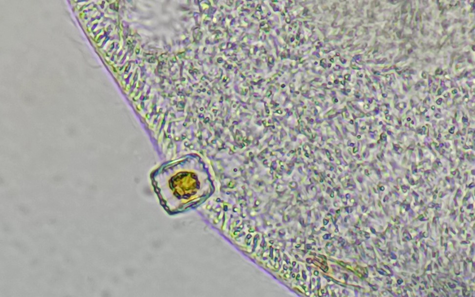 [图]草履虫消化不了硅藻，吐了出来。