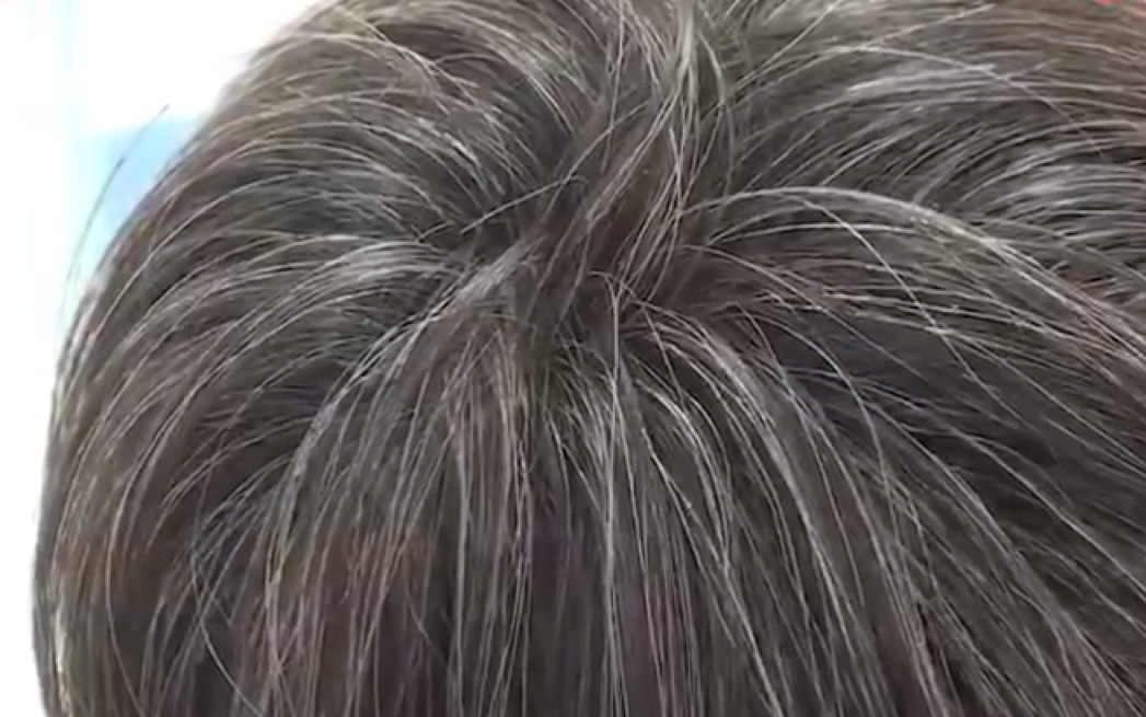 14岁少年长满白发,甚至比母亲的多几十倍!老中医一番话道出真相!