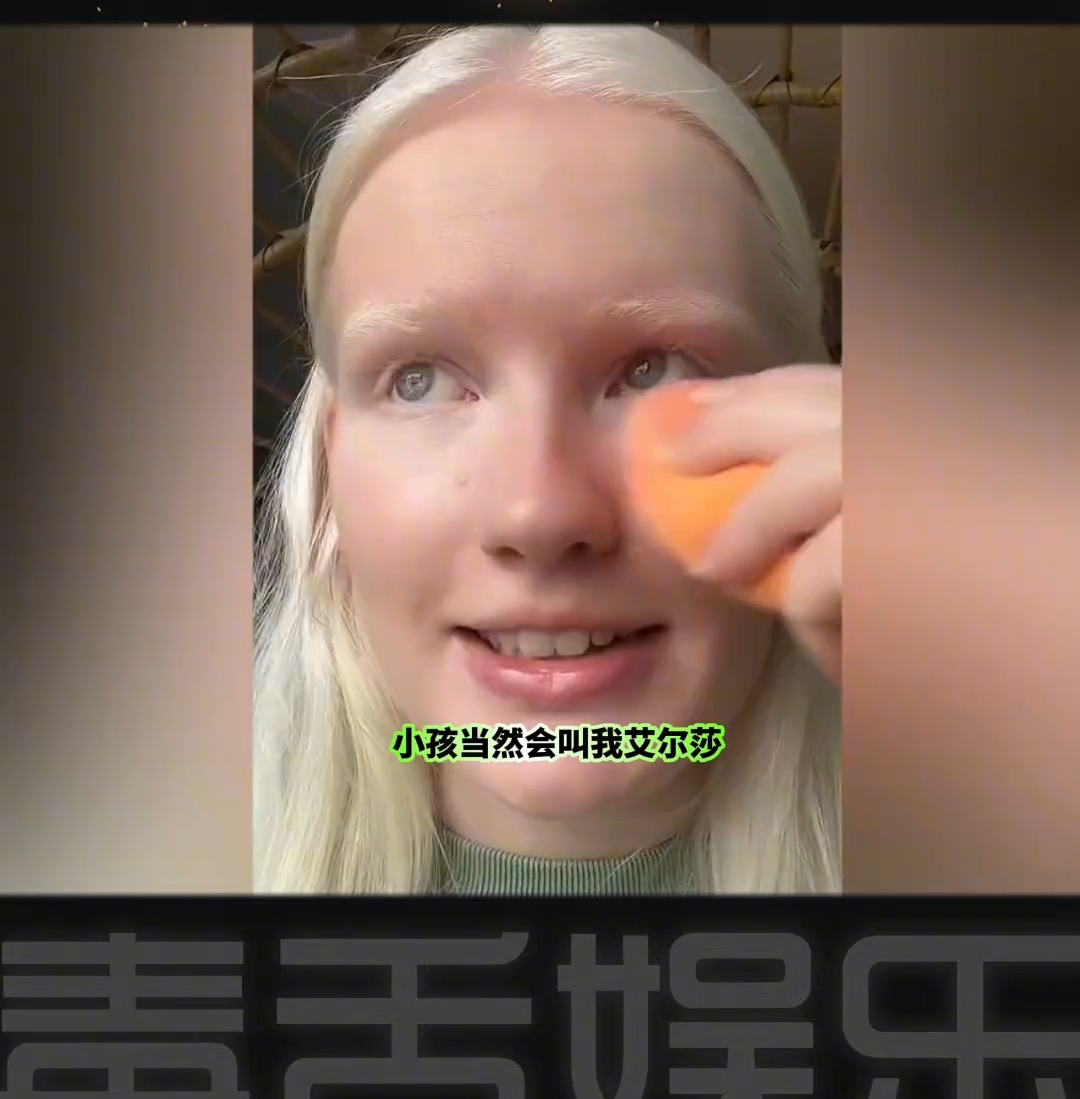 白化病小姐姐生活中会遇到的那些恶意