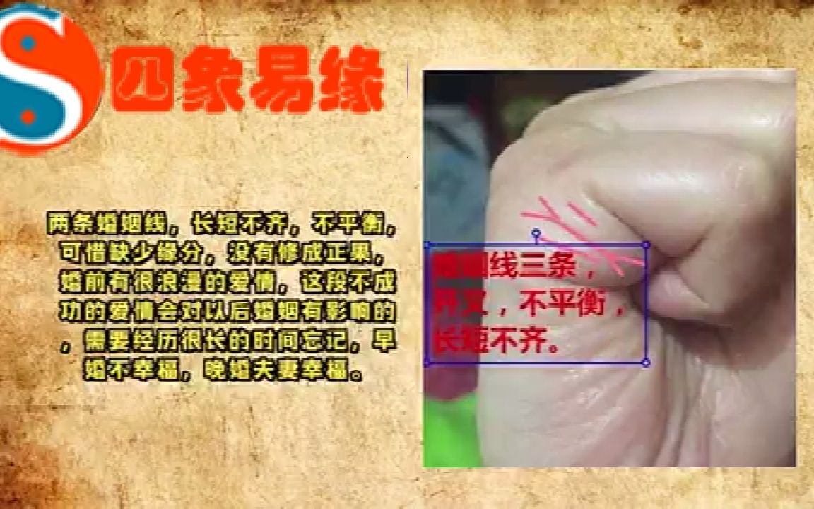 四指不聚拢三线不清做事思想不集中,工作生活中容易疲劳哔哩哔哩bilibili