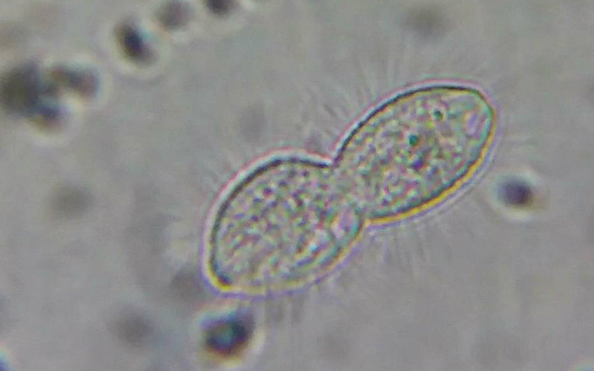 几种水生微生物,草履虫哔哩哔哩bilibili