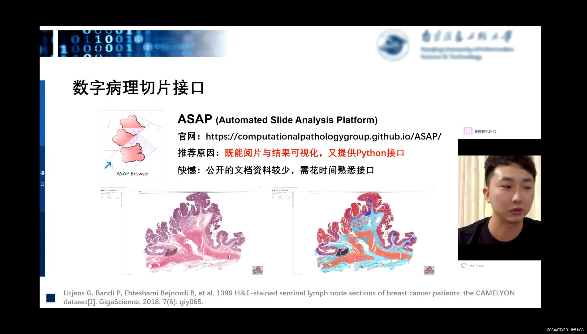 数字病理切片及数据接口1(全切片的读取)哔哩哔哩bilibili