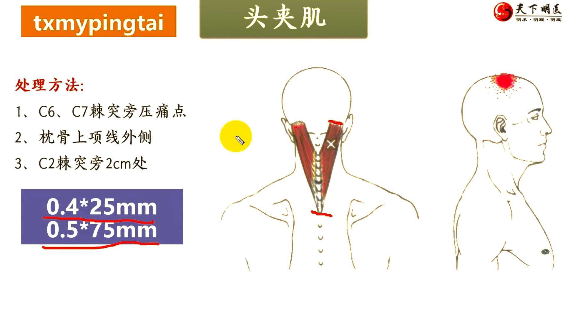 头夹肌损伤图片