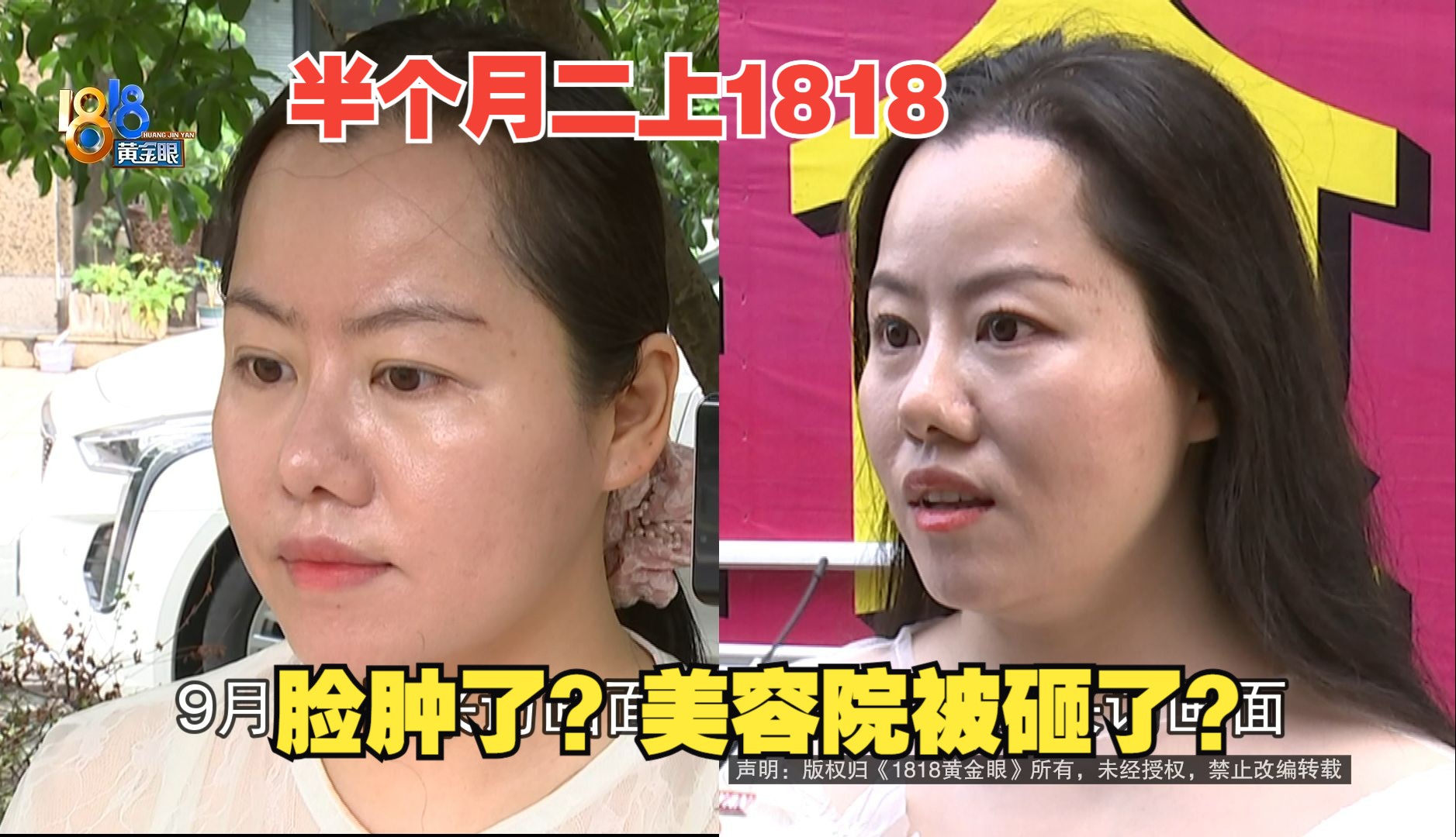 【1818黄金眼】女子称做激活导入后脸肿,有人拿着大锤来过?