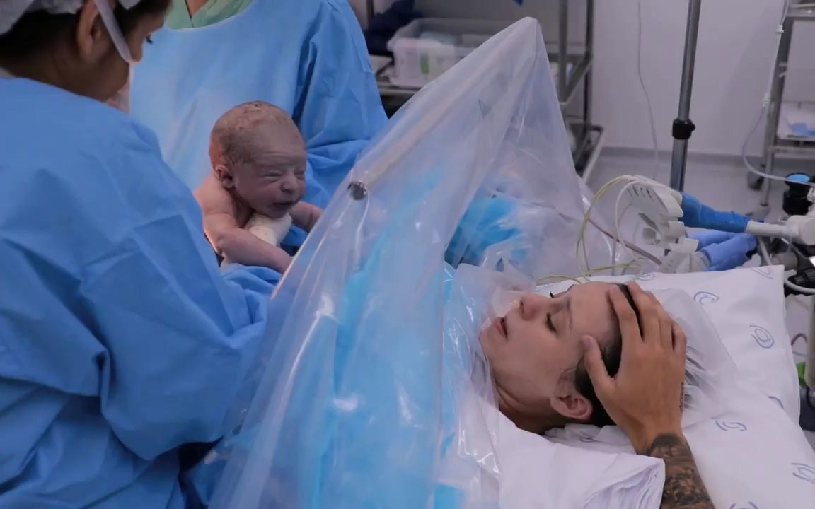 实录孕妇感人的剖腹产分娩过程刚出生一分钟的小宝宝你见过吗