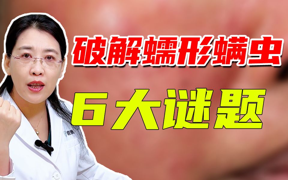 螨虫过敏会有哪些症状?该怎么办呢?哔哩哔哩bilibili