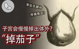 Video herunterladen: 【子宫脱垂】子宫会慢慢掉出体外？不生也有风险？这些雷区你踩了吗？【灰细胞】