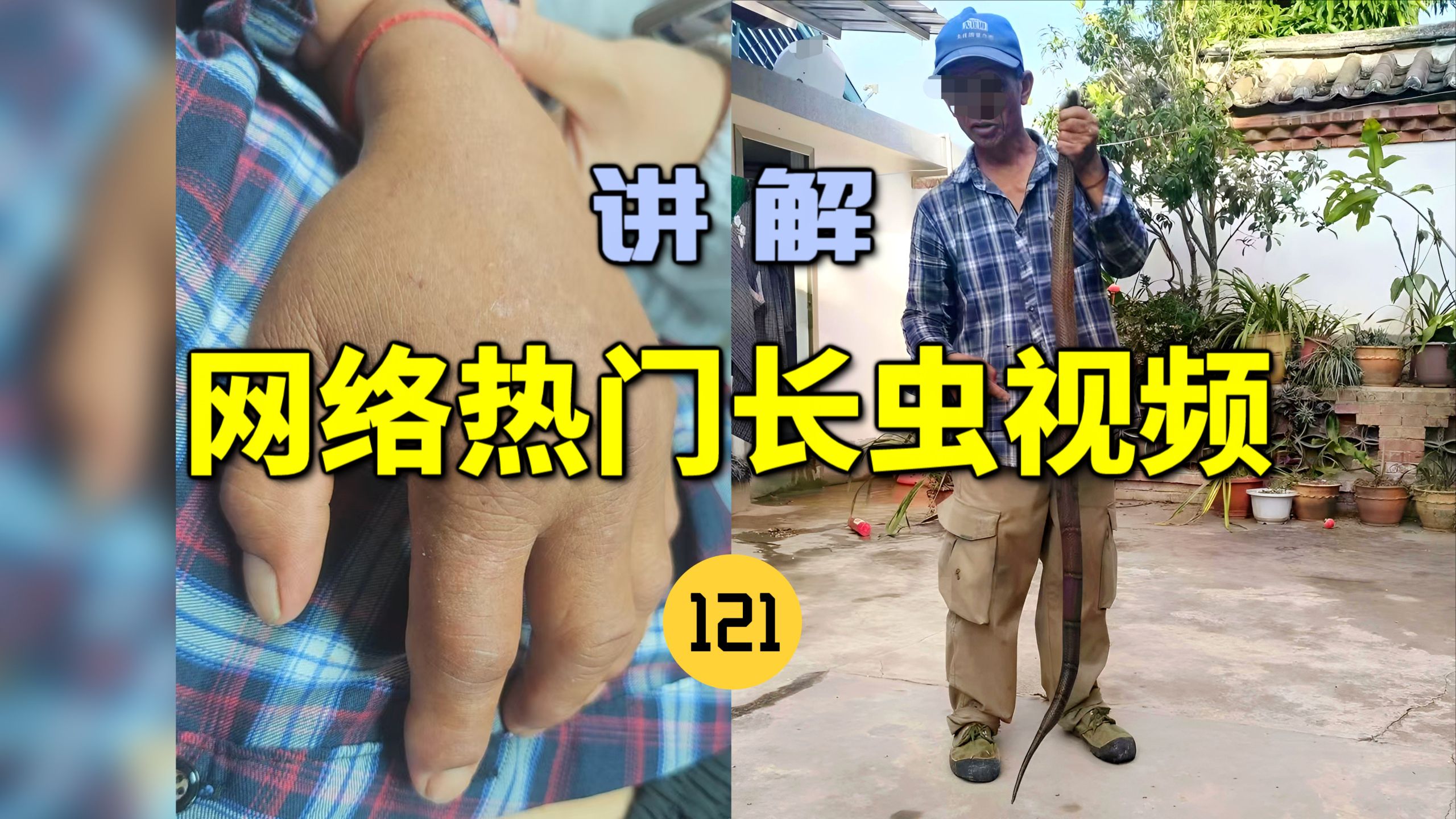 网络热门长虫视频(121)刷新认知！云南一男子徒手抓西南眼镜蛇被咬伤后出现严重神经毒症状？