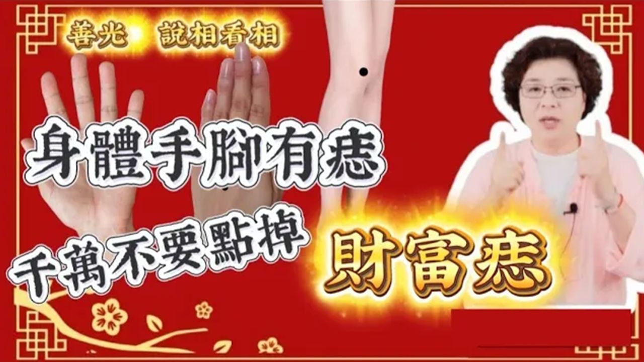 財富痣千萬別點掉身體手腳有痣的人超級旺財