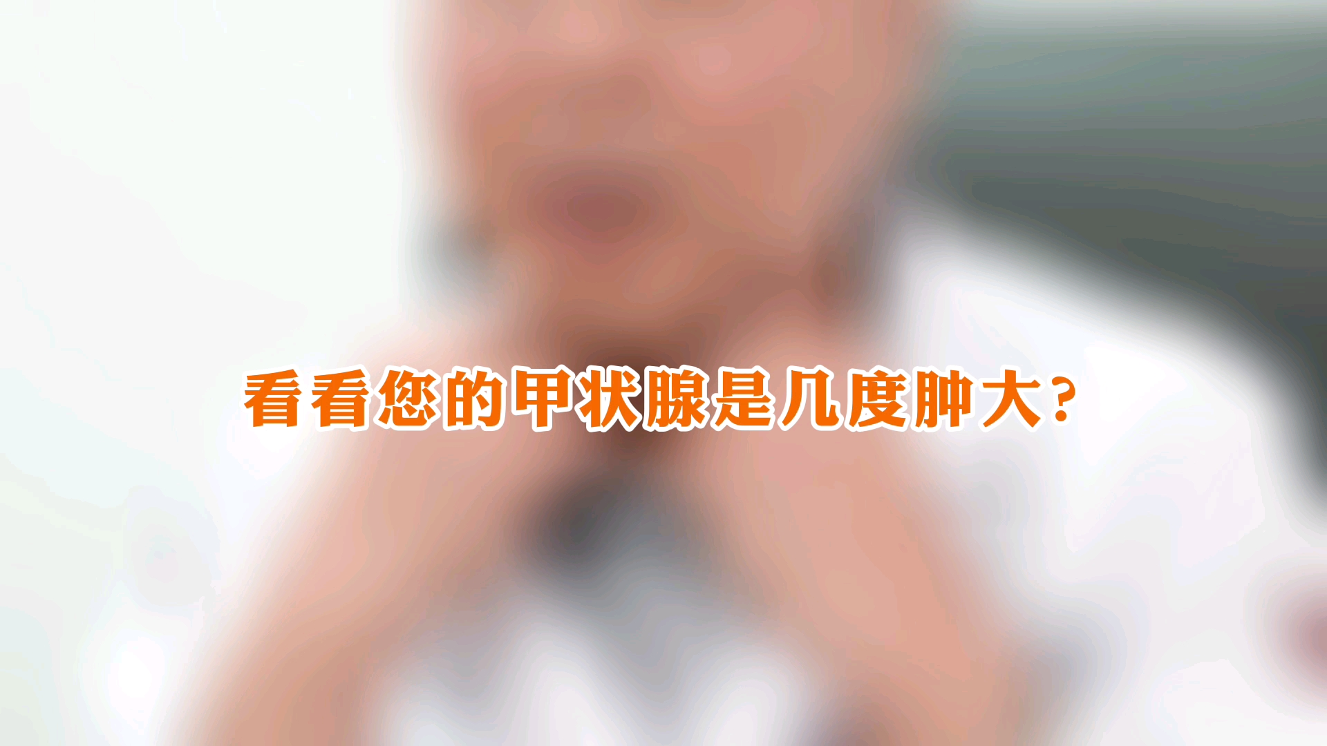 看看您的甲状腺是几度肿大哔哩哔哩bilibili