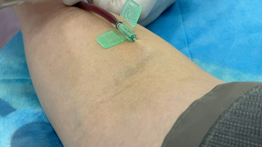 献血针头多粗图片