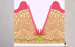 Tải video: 我只是拔了一颗牙，但干槽症却让我体验了一次现代版的“刮骨疗伤