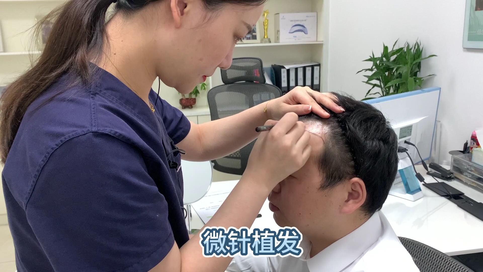 剃发植发的头发(植发剃发好还是不剃发好)