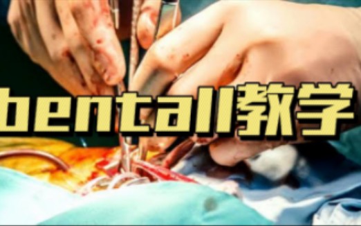 bentall教学哔哩哔哩bilibili