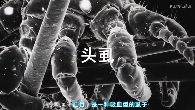 全球10种最危险寄生虫,仅中国就有7种!哔哩哔哩bilibili