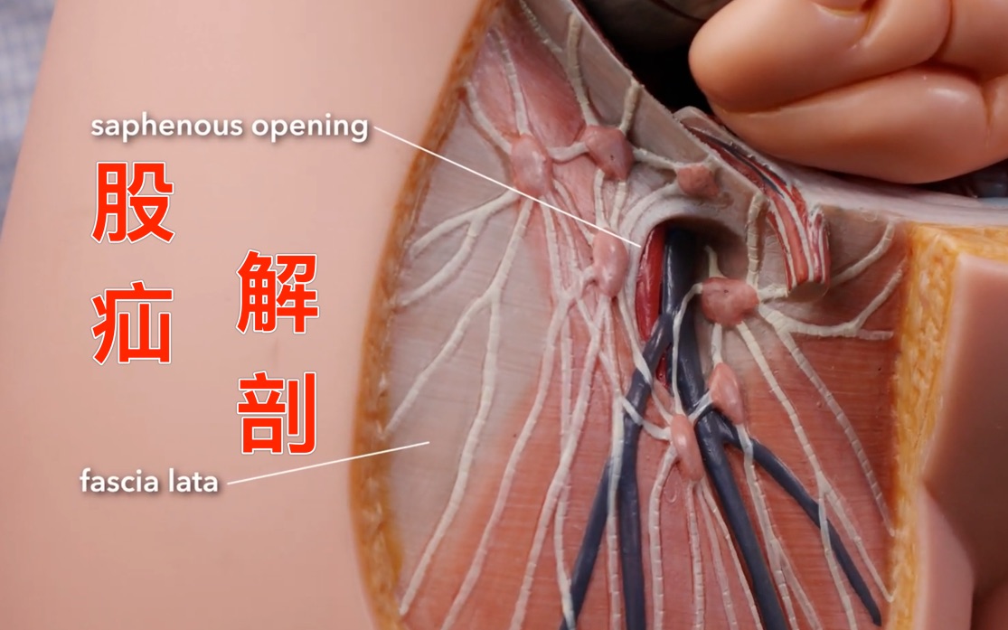 [图]【解剖】股疝Femoral hernia anatomy