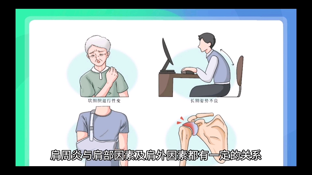 肩周炎的病因