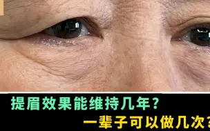 Download Video: 提眉能维持几年？