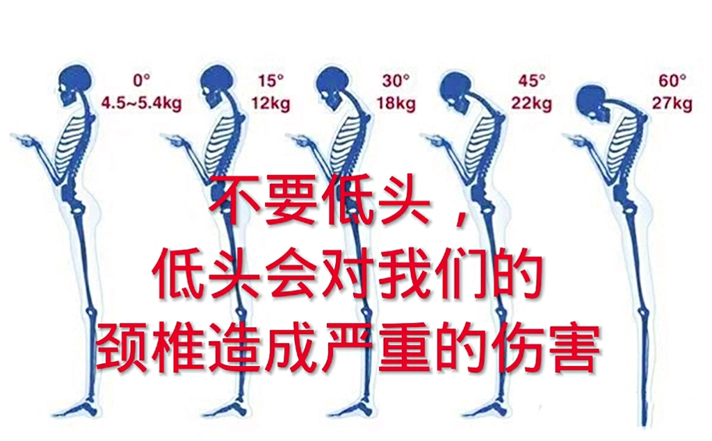 低头玩手机的注意了,长期低头对我们的颈椎损伤最严重.