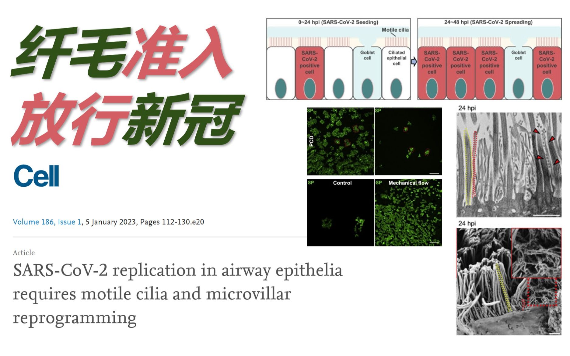 【文献速递】新知19 新冠病毒纤毛细胞侵染扩散 奥密克戎修桥补路畅行无阻哔哩哔哩bilibili