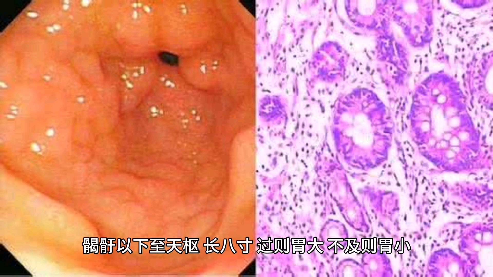 [图]黄帝内经 灵枢 第十四篇