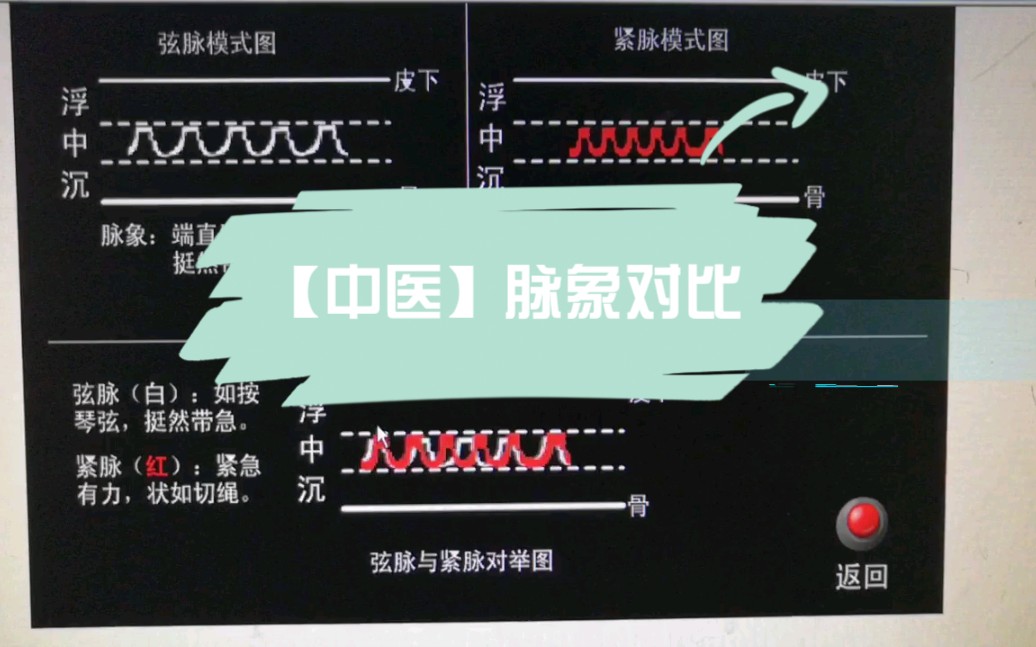 【中医】脉象对比诊脉区别模式对比图哔哩哔哩bilibili