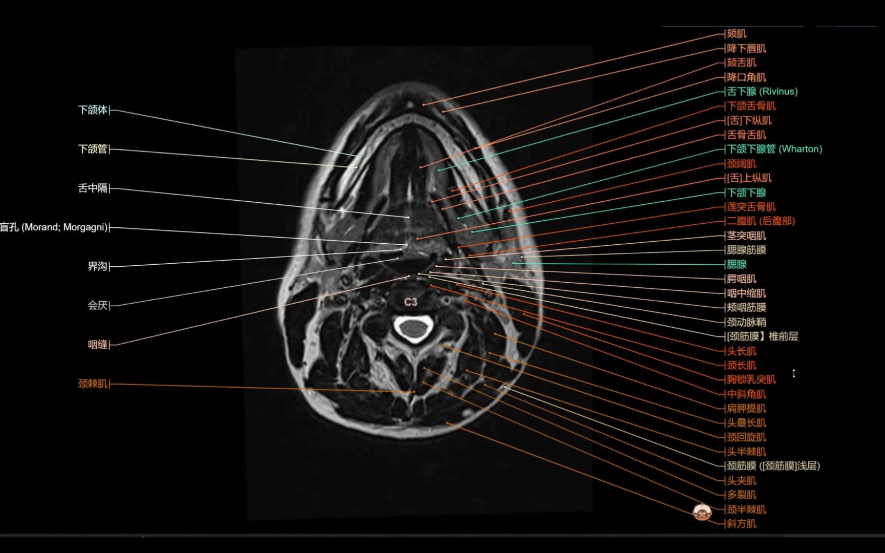[图]必须收藏！超详细的头颈部MRI解剖逐帧播放！