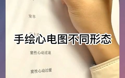 心电图各种形态,你会画吗?哔哩哔哩bilibili