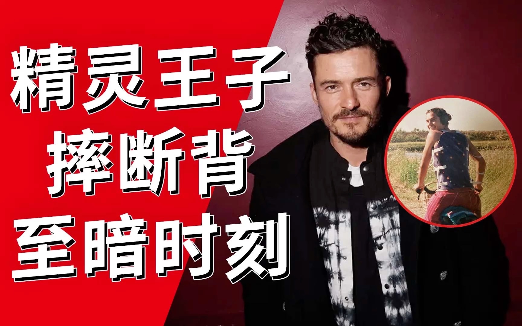 哭了!精灵王子Orlando Bloom19岁摔断背,迎来人生至暗时刻……哔哩哔哩bilibili