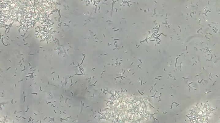 细胞污染之黑胶虫密恐勿点