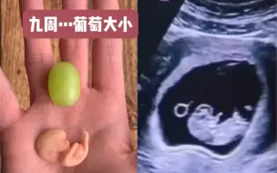 下载视频: 孕早期胎儿有多大？B超和实物带你直观了解！