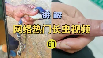 Descargar video: 网络热门长虫视频(67)粉丝的亲戚疑似被银环蛇咬伤？养蛇人却说是猫咬的？到医院才发现虚惊一场！