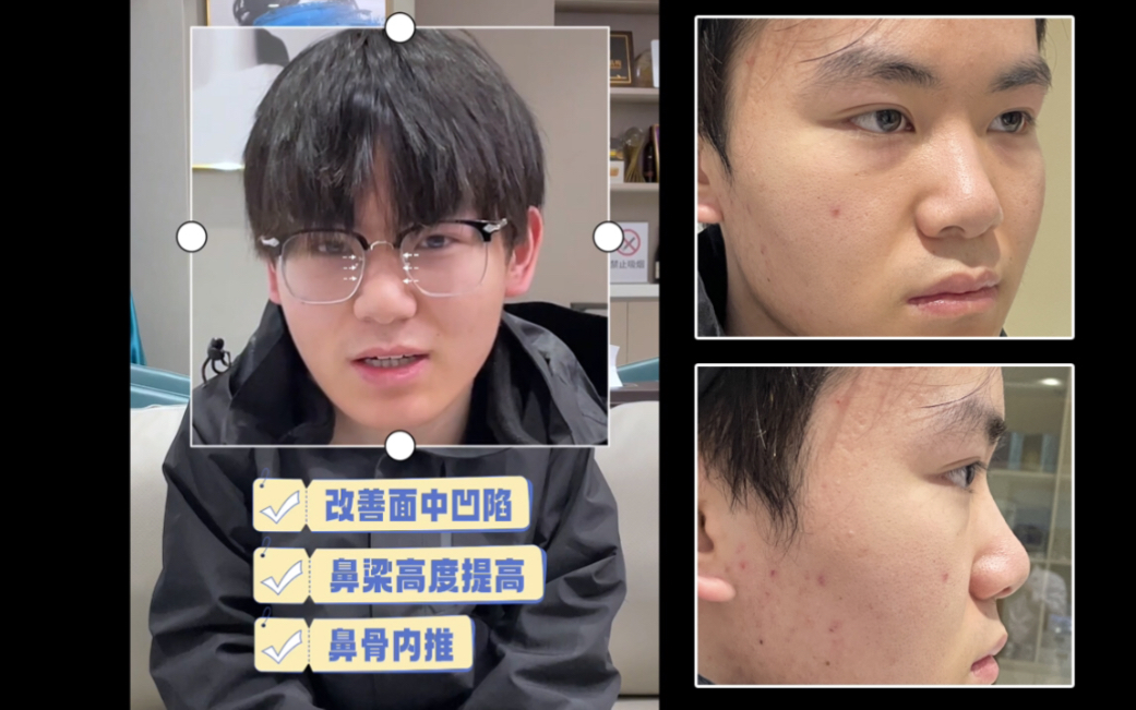 我的do鼻记录,做完好像更man