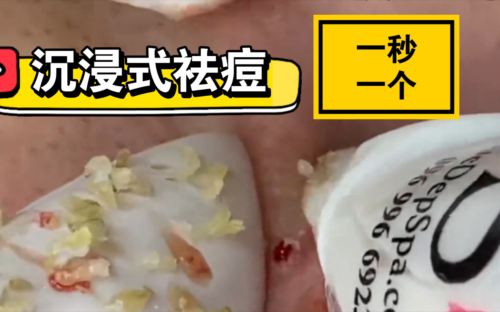 快来看看吃什么菜【解压助眠】针清|面部护理|深层清洁|黑头粉刺|毛孔