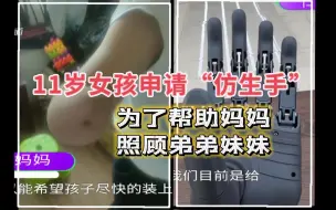 Download Video: 11岁女孩申请第四例“仿生手”：有了手就可以帮妈妈照顾弟弟妹妹了…