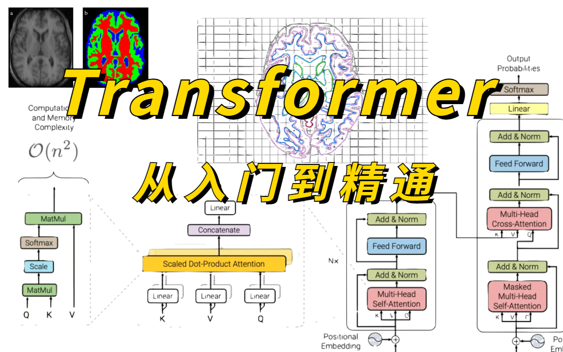 我从未见过如此通俗易懂的Transformer教程!从放弃到精通的MedicalTransformer源码解读+DERT目标检测+医学分割人工智能课程哔哩哔哩bilibili