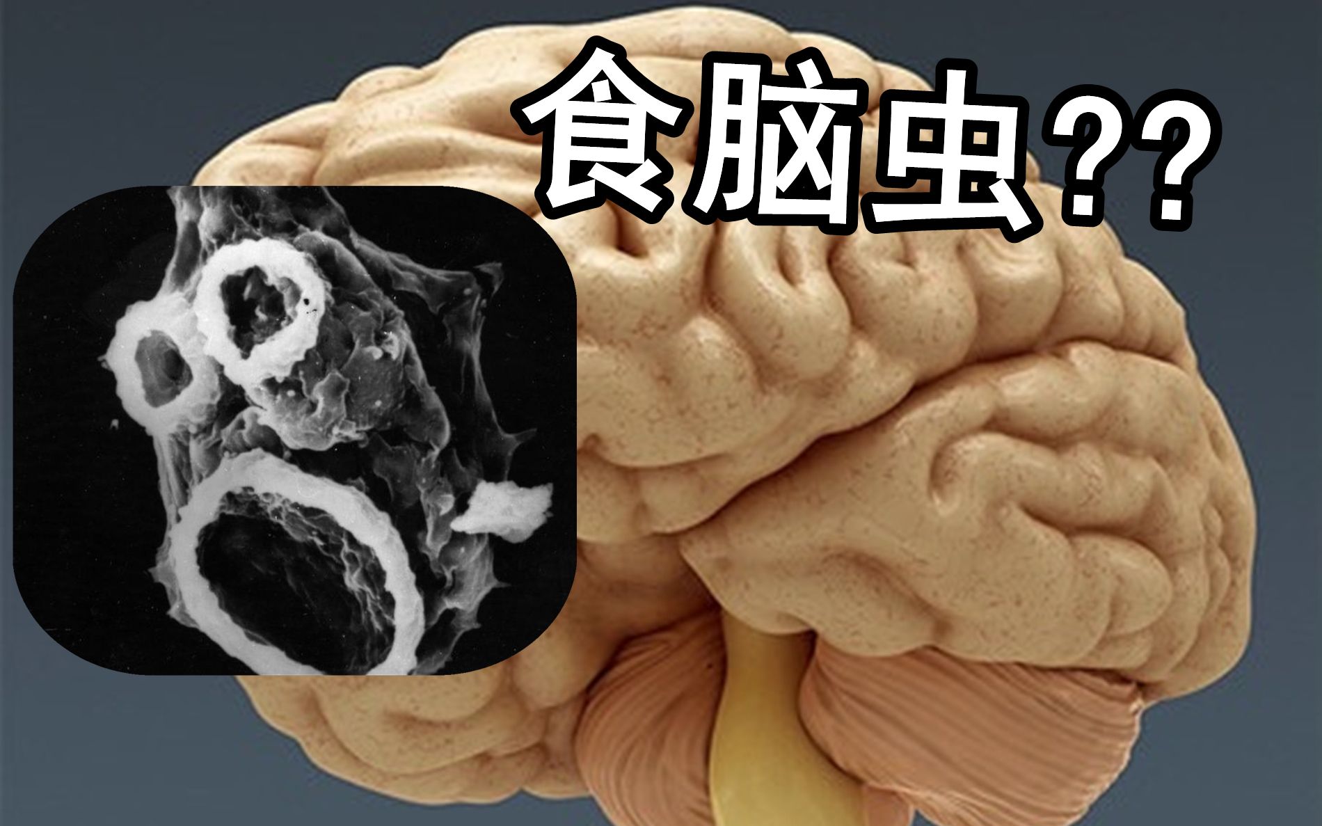 [图]【寄生虫第五季1】食脑虫：游泳，喝水导致身患绝症？钻入脑子的寄生虫如何预防？寄生虫系列第五季第一期：食脑虫